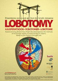 Лоботомія